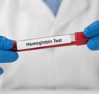 Hemoglobin
