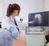 Kidney USG