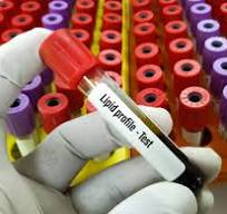 Lipid Panel