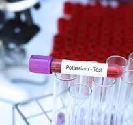 Potassium Test
