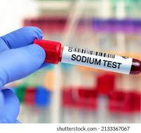Sodium Test