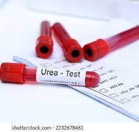 Urea Test